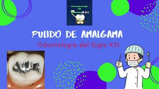 Pulido de amalgama dental [upl. by Moffat]