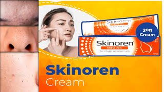 Skinoren cream how to use  Azelaic acid how to use [upl. by Norb848]