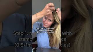 Receding hairline Try this dermatologist hack hairloss minoxidil [upl. by Adley]