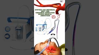 Stryker AXS Universal NextGen Thrombus Aspiration Device Medical Animation 3d short [upl. by Atnuhs190]