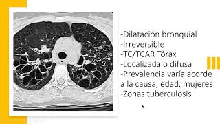 Bronquiectasias [upl. by Joris322]