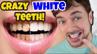 Get CRAZY WHITE Teeth  Best Teeth Whitening Products That Work  Chris Gibson [upl. by Yeliab804]