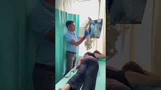 Most challenging scoliosis case treatment by DrRavi scoliosis chiropractic spine shorts reels [upl. by Medeah1]