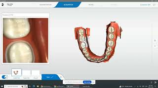 Primescan Scanning Techniques [upl. by Kathy476]