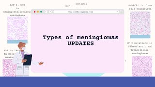 Meningioma Subtypes Grades and Updates 2021 [upl. by Ane]