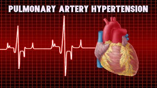 Pulmonary Artery Hypertension  PAH [upl. by Yesmar]