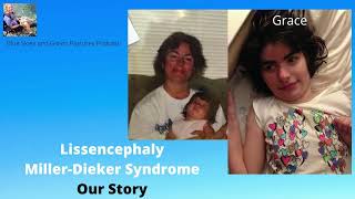 Lissencephaly and Grace Our Story [upl. by Ahsiekim826]