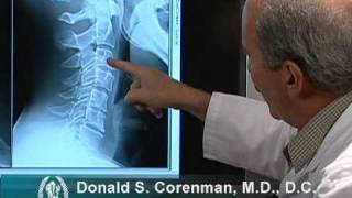 How to Read Xrays of the Cervical Spine Neck  Colorado Spine Expert [upl. by Yemirej]