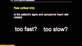 1215 Lead ECG Step by Step Approach [upl. by Babette110]