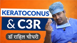 Keratoconus and C3R Corneal Cross Linking Treatment In Hindi [upl. by Nhabois251]