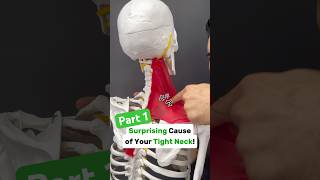 Part 12 Is your neck tight with shoulder blade or arm pain Try this neckpain shoulderpain tmj [upl. by Penrod]