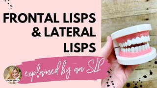 FRONTAL LISP VS LATERAL LISP explained by an SLP [upl. by Barbabas543]