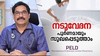 നടുവേദന മാറാൻ ഏറ്റവും എളുപ്പ മാർഗം  Back Pain Treatment in Malayalam Health Tips [upl. by Elena]