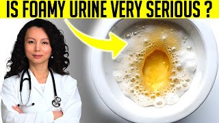 Top 5 Reasons Of Foamy or Bubbly Urine One Is Kidney Disease [upl. by Portland359]