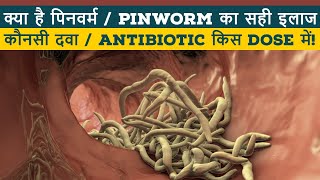 Chunna katne ka ilaj II Pinworm treatment lI Pinworm ki dawa II Chunne ka ilaj II ThyDoc [upl. by Peer]