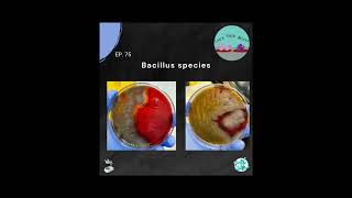 75 Bacillus species [upl. by Lorelie]