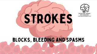 Stroke Review Blocks Bleeds and Spasms [upl. by Woodley]