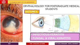 Infectious Keratitis LECTURE 3 Fungal amp Viral KERATITIS [upl. by Neellok359]