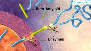 How Alzheimers Disease Works Animation Causes Stages Symptoms Diagnosis Treatment Prevention Video [upl. by Broucek]