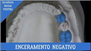 Enceramento negativo dos Posteriores Inferiores [upl. by Ymme]