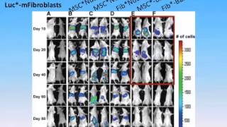 Understanding Mesenchymal Stem Cell and Considerations for Treatment by Mark F Pittenger PhD [upl. by Ihsoyim]