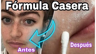 CREMA PARA DEPILAR CASERA  🔥FACIL DE HACER🔥  SIN GASTAR DINERO [upl. by Gonnella825]