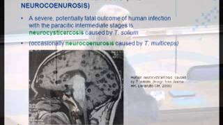 Taenia solium cysticercosis Life cycle epidemiology and diagnosis Dr L Odendaal [upl. by Byram]