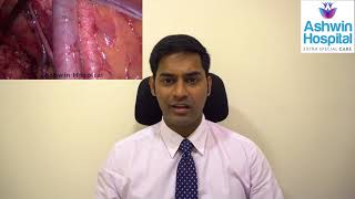 Patient education video on Uterine Cervical and Ovarian cancers [upl. by Asyl414]