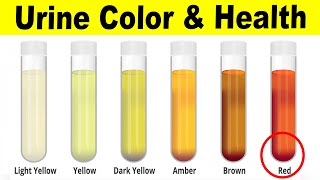 What The Color Of Your Urine Says About Your Health [upl. by Adlaremse]