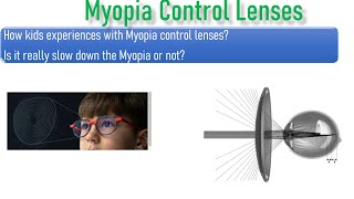 How myopia control lenses works and experience of kids with myopia control lenses [upl. by Aierbma]