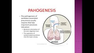 Ventilatorassociated pneumoniaVAP [upl. by Aztiraj154]