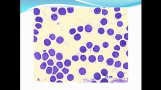 Rickettsial diseasesAnaplasmosis and Q fever ppt [upl. by Kafka280]