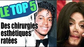 Le top 5 des chirurgies esthétiques ratées [upl. by Mac]