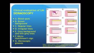 Longitudinal Melanonychia  LECTURE SEGMENT ONLY  Chris Adigun MD DERMfoot 2016 [upl. by Orsay476]