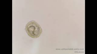 Embryonated Toxocara egg │wwwuplbparaslabwebscom [upl. by Lacram]