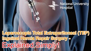 Laparoscopic Total Extraperitoneal TEP Inguinal Hernia Repair Surgery  Explained [upl. by Rustin]