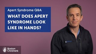 What does Apert syndrome look like in hands  Boston Childrens Hospital [upl. by Rick]