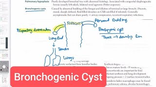 Bronchogenic Cyst Respiratory System 4  First Aid USMLE Step 1 in UrduHindi [upl. by Donadee]