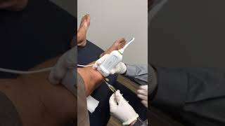 Prepatellar Bursa Aspiration  Elite Sports Medicine  Lethbridge [upl. by Ettellocin]