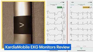 KardiaMobile Personal EKG Monitors Review [upl. by Kaiser]