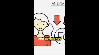 Iron Deficiency Anemia Causes amp Solutions shorts [upl. by Maleki]