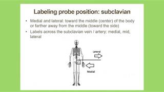 Duplex Scanning of the Subclavian Veins and Arteries September 2018 [upl. by Oab]