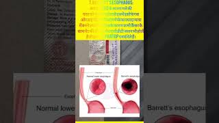 PANTOP 40। Pantoprazol।Uses in Hindi।Part2।pantoprazole pantop ulceraciditygasUlcer Gas Acidity [upl. by Hirst95]