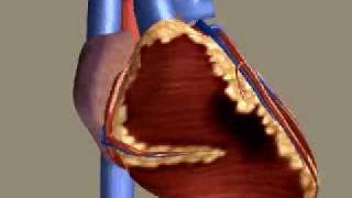 Myocardial Infarction [upl. by Nairret]