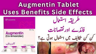 How To Use Augmentin 625mg Tablets Used For In Urdu  Side Effects [upl. by Demitria]