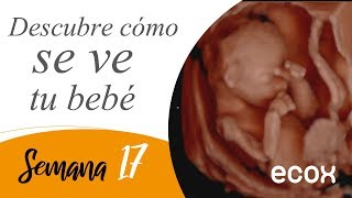 ¿cómo se ve si es NIÑO o NIÑA por ULTRASONIDO SEMANA 21 A 39 por GINECOLOGA DIANA ALVAREZ [upl. by Hampton618]