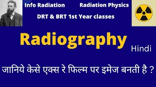 radiography in hindi  DRT amp BRT 1st year classes radiography radiology xray radiation [upl. by Bayard558]