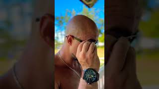 how to save myself from my bald spot😁 baldhead comedy funny [upl. by Ferdinanda]