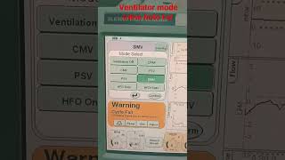 ventilator me mode kitne hote hai hospital doctor aims viral  shorts [upl. by Flin293]