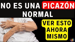 ¡Pica En Estos 5 Lugares Tu Vida Podría Estar Acortándose  Saludable y Feliz [upl. by Naivaj]